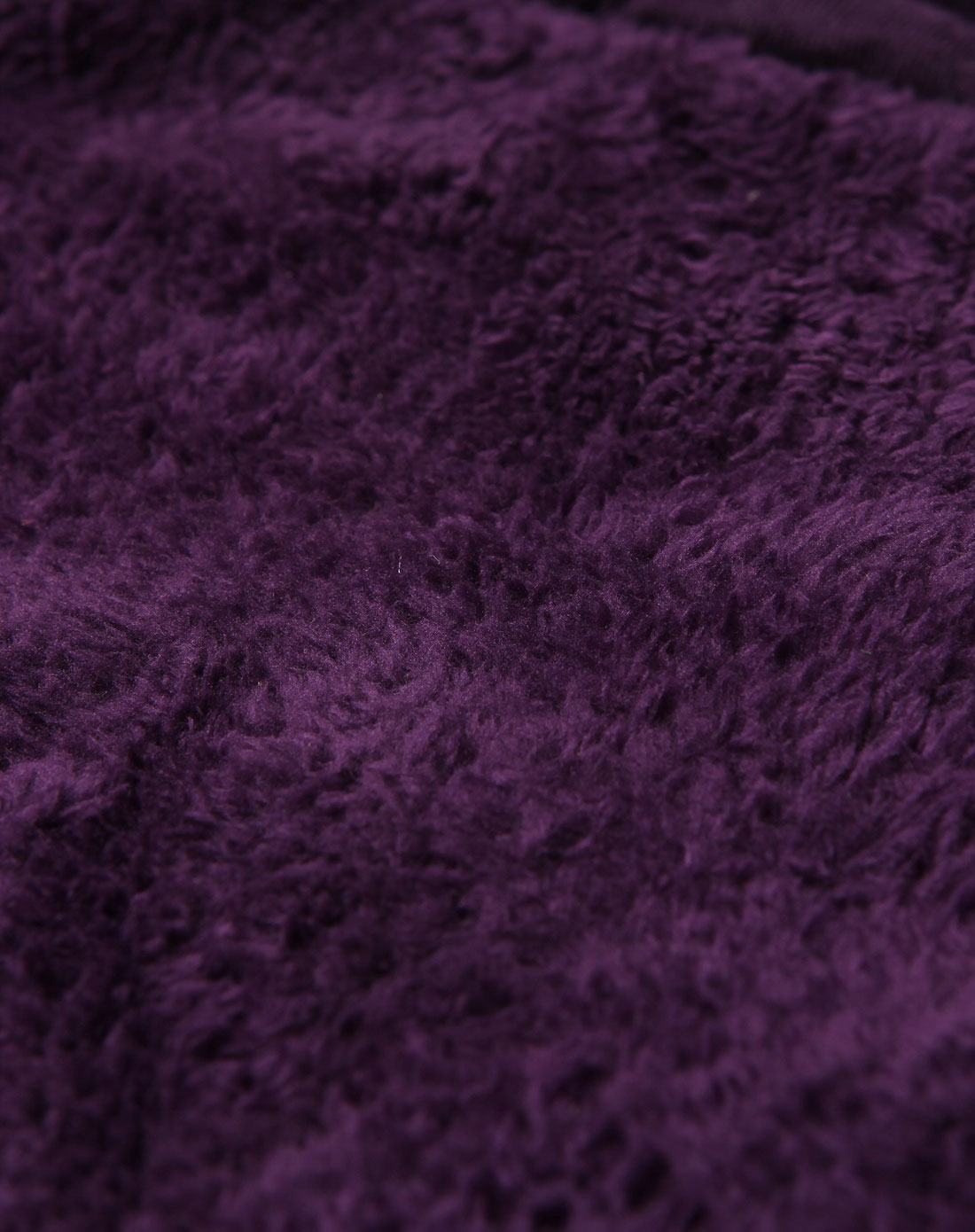 身上莫名奇妙出现深紫色淤青是怎么回事?