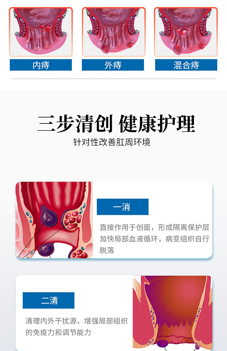 痔疮型冷敷凝胶痔疮膏男女消肉球痔疮肛裂便血内痔外痔混合痔苍