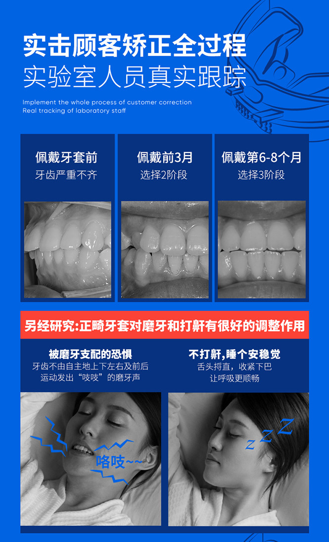牙齿矫正牙套隐形透明保持器成人整牙磨龅牙神器地包天夜间矫正