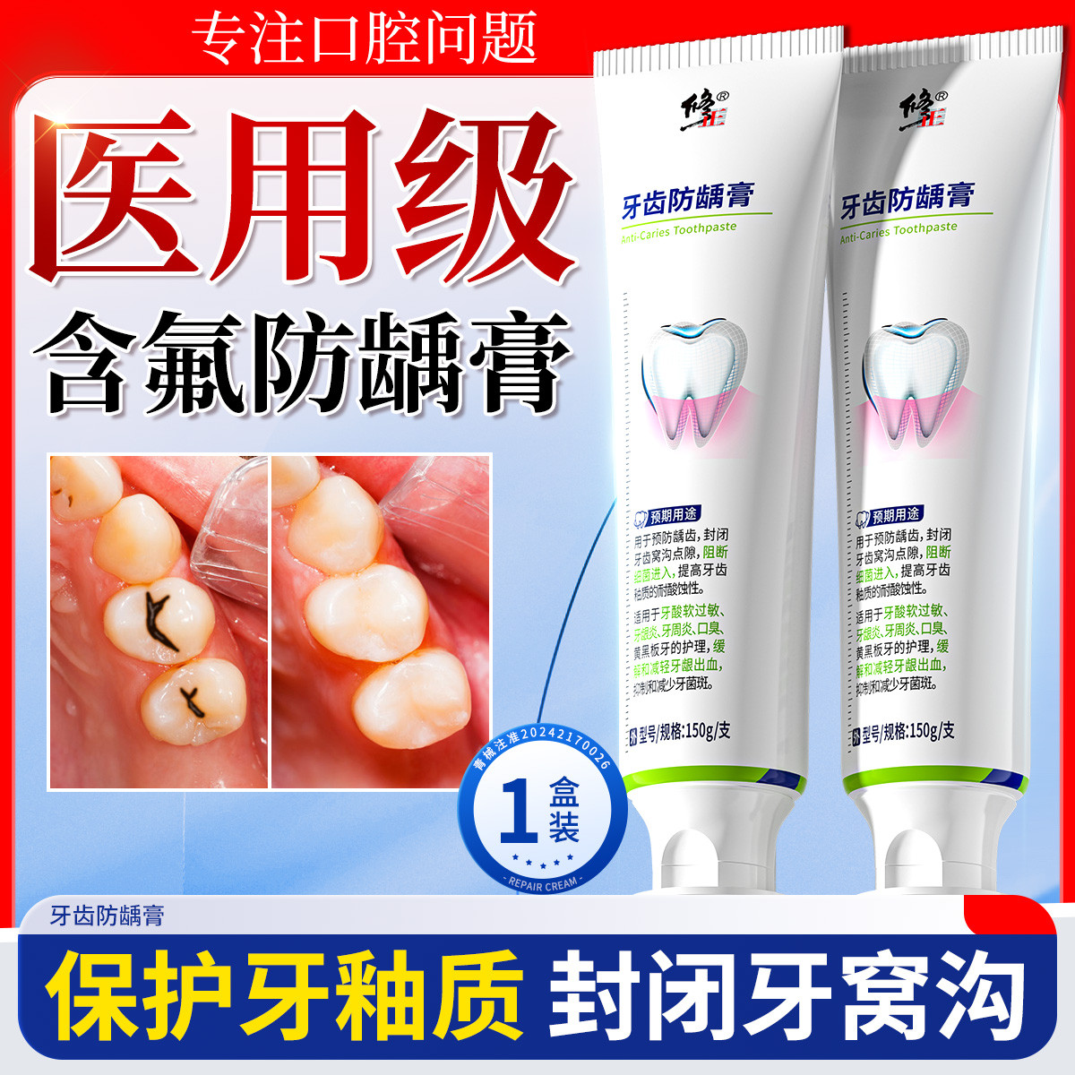 修正 医用防龋防蛀膏牙齿去黄白牙渍口臭含氟牙龈敏感牙菌斑牙周炎抑菌