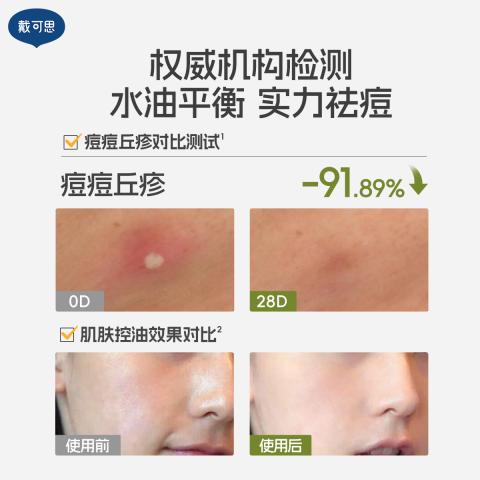 戴·可·思 【青少年护肤2.0】控油祛痘洗面奶水乳精华男女学生青春期套装 图片 4