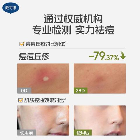 戴·可·思 【青少年护肤2.0】控油祛痘洗面奶水乳精华男女学生青春期套装 图片 10