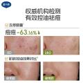 戴·可·思 【青少年控油面膜】青少年平衡调理面膜男女学生清洁保湿控油面膜 图片 4