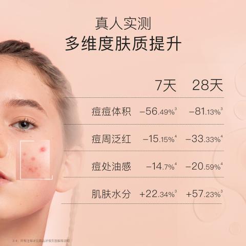 贝德美 青少年祛痘修护霜青春期控油保湿青少年面霜敏感肌适用 图片 4