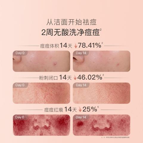 贝德美 【控油祛痘】青少年洗面奶青春期清洗控油平衡洗面奶学生护肤品 图片 2