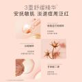 贝德美 【祛痘祛粉刺】青少年祛痘精华霜无酸祛痘舒缓改善红敏痘肌精华霜 图片 6